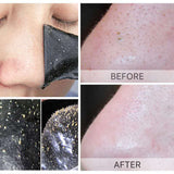 Blackhead Cleansing Patch